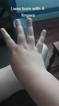 4 Fingers Meme